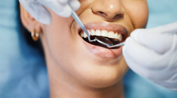 Best Emergency Wisdom Teeth Removal in Hamburg, IA